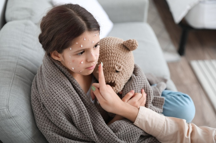 Феницитол назначается при ветряной оспе, краснухе и кори.