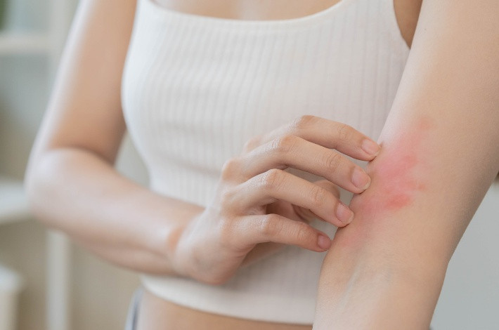 Димедрол назначается при различных кожных аллергиях.