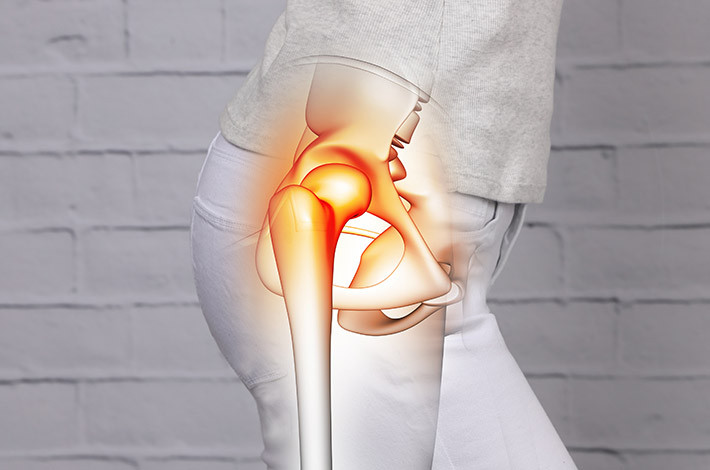 Алендронат