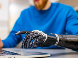 Бионические протезы